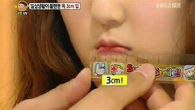 韓國鳥嘴女「嘴巴僅3cm」連漢堡都不能吃！她：很困擾
