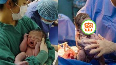 巴西女嬰出生一副「臭臉」，怒瞪醫護人員，網友：又有新表情包了