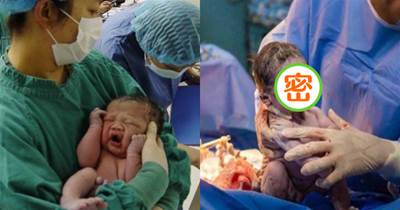 巴西女嬰出生一副「臭臉」，怒瞪醫護人員，網友：又有新表情包了